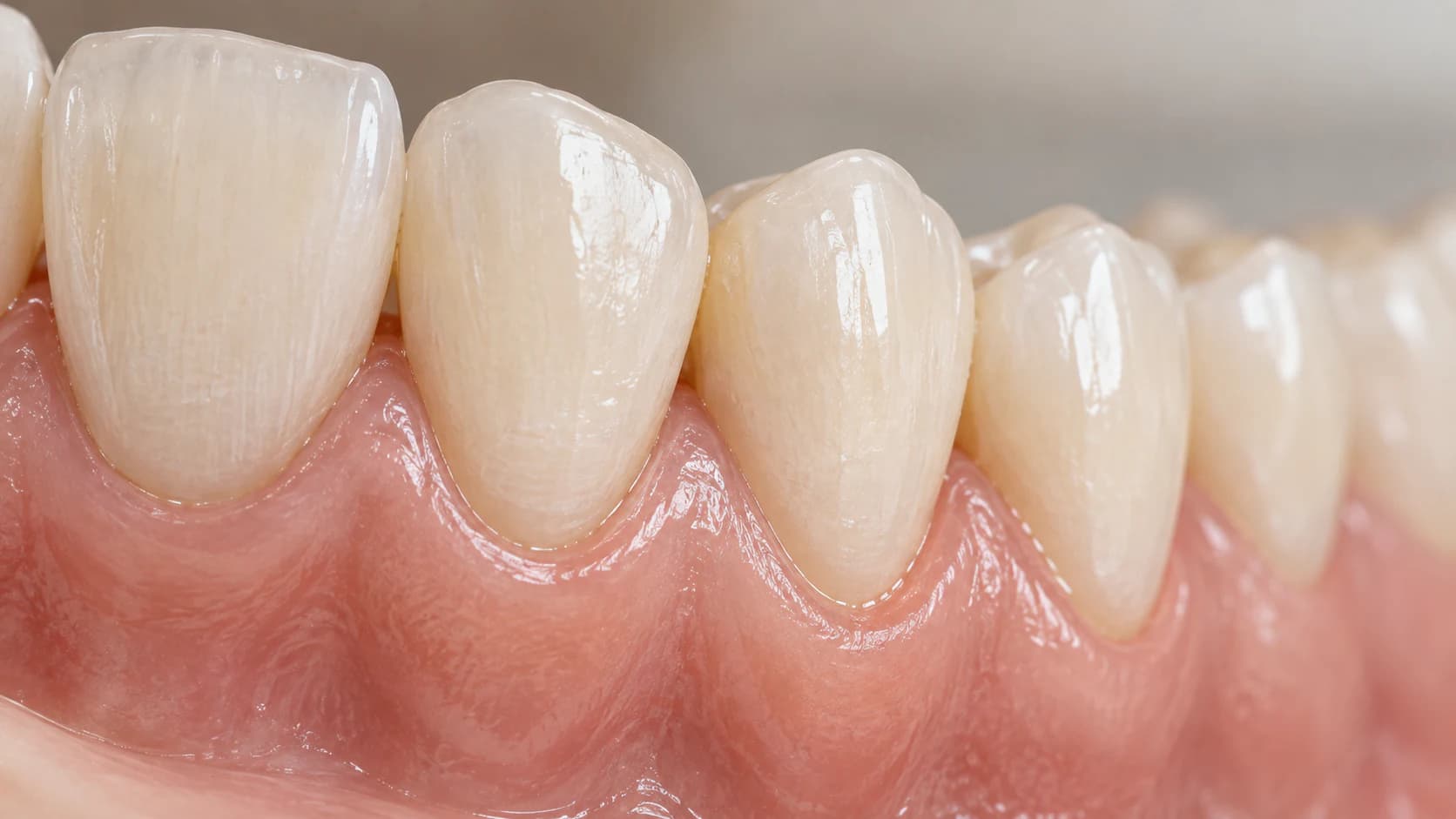 Healthy Gingival Margin and Periodontal Architecture Detail at Agarwal Dental Clinic